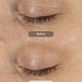 9256327e9ef9d001615ab02a924ccc0702b84d8e_RS_dej_eye_cream_4